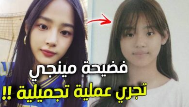 فضيحة مينجي عضوة نيوجينز تجري عملية تجميلية فضيحة مينجي عضوة نيوجينز تجري عملية تجميلية